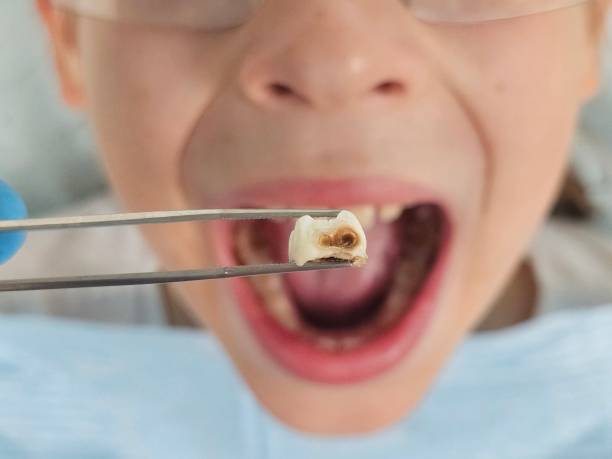 Best Pediatric Emergency Dentist in Brookhaven, MS